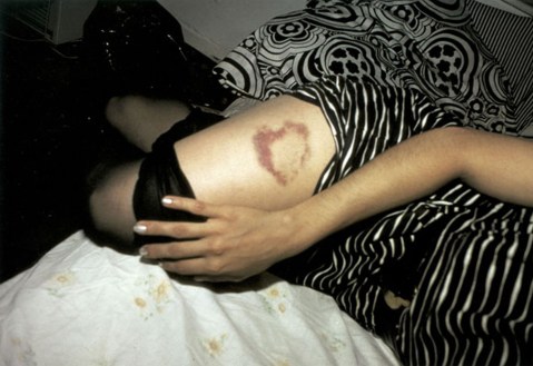 nan-goldin-heart-shaped-bruise-board
